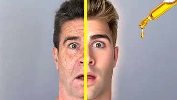 I Put CASTOR OIL on Just One Side of My Face - Every Day for a Week Preview