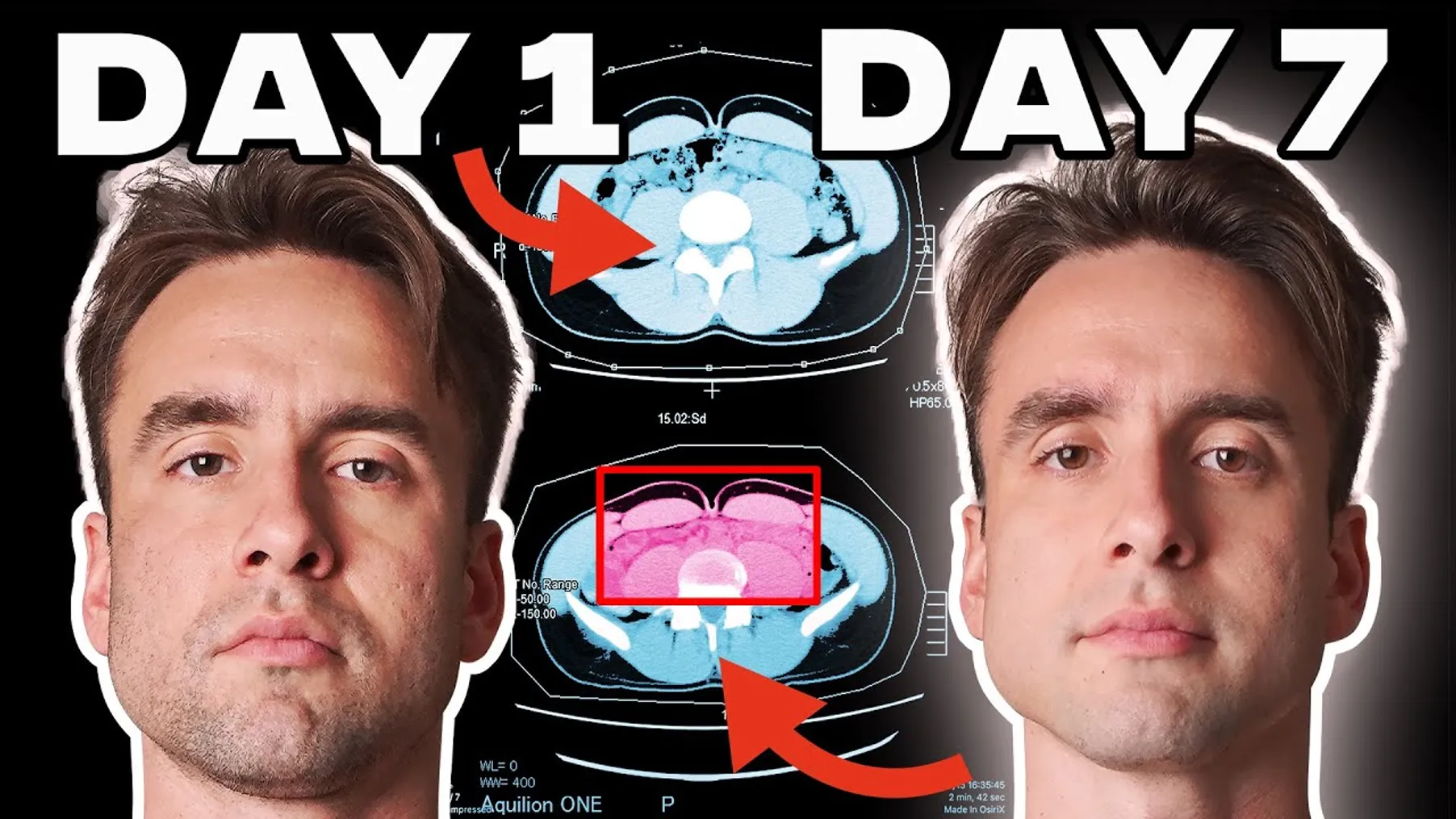 I Didn't Eat Food for 7 days. This is what happened to my body Preview