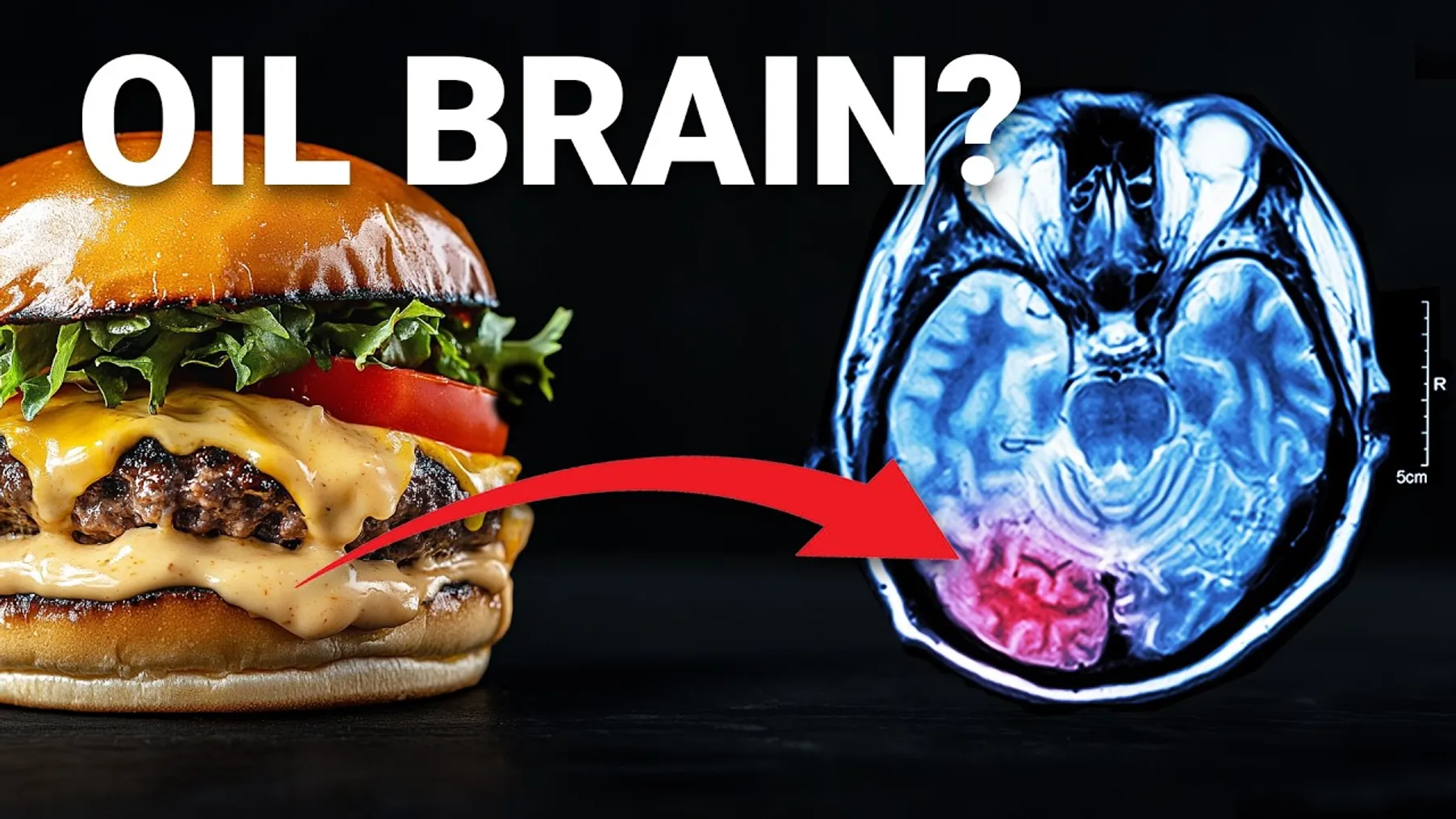 The $212 Billion Dollar Food ingredient poisoning your Brain Preview