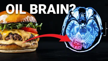 The $212 Billion Dollar Food ingredient poisoning your Brain Preview