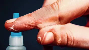 Why Super Glue Is Perfect For Gluing Skin Preview