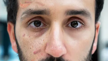 My Evidence-Based Skincare Routine Preview