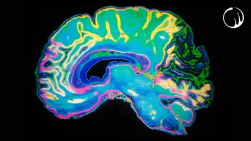 One of the Most Unsettling Phenomena of the Human Brain Preview