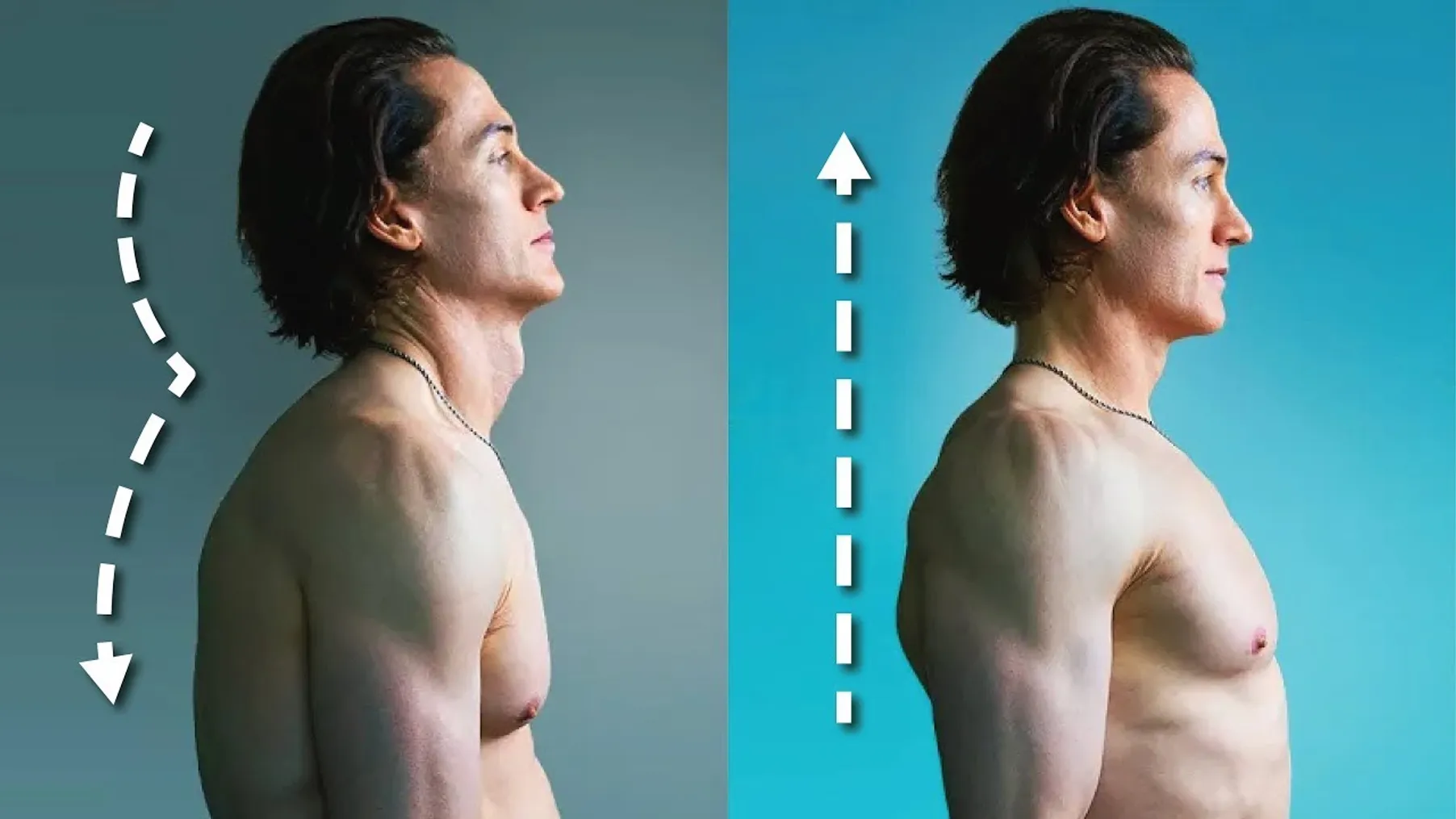 How I Fixed My Terrible Posture - 5 Habits Preview