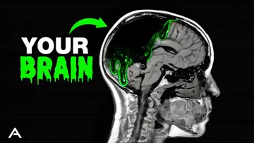 Brain Rot is Far Worse Than You Think Preview