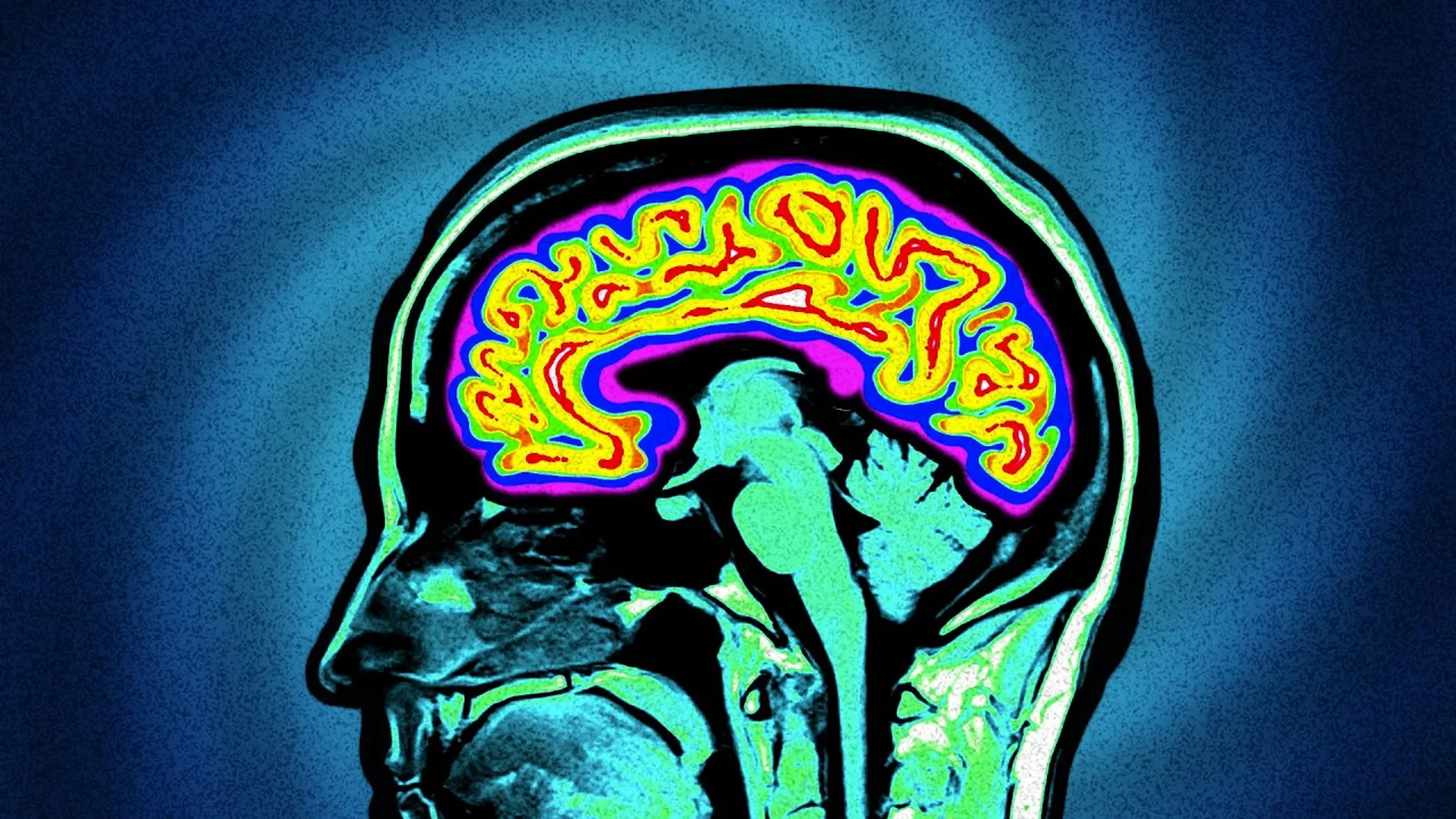 What Enlightenment Does to Your Brain Preview