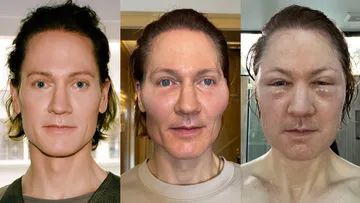 I Tried To Make My Face Younger Preview