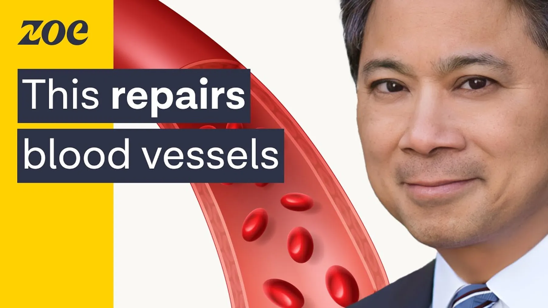 Heart expert: dementia may start in your blood vessels — here’s how to prevent it. | Dr. William Li Preview